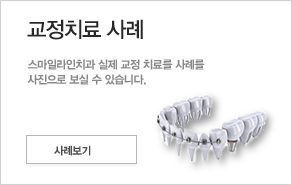 교정치료 사례