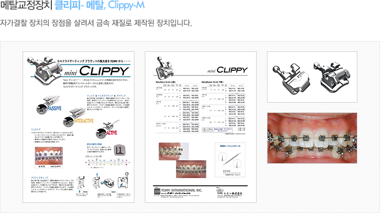 메탈교정장치 클리피- 메탈, Clippy-M 자가결찰 장치의 장점을 살려서 금속 재질로 제작된 장치입니다.