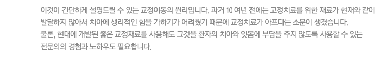 이것이 간단하게 설명드릴 수 있는 교정이동의 원리입니다. 과거 10 여년 전에는 교정치료를 위한 재료가 현재와 같이 발달하지 않아서 치아에 생리적인 힘을 가하기가 어려웠기 때문에 교정치료가 아프다는 소문이 생겼습니다. 
물론, 현대에 개발된 좋은 교정재료를 사용해도 그것을 환자의 치아와 잇몸에 부담을 주지 않도록 사용할 수 있는 전문의의 경험과 노하우도 필요합니다. 