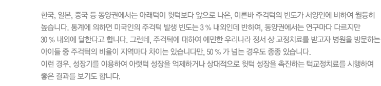 한국, 일본, 중국 등 동양권에서는 아래턱이 윗턱보다 앞으로 나온, 이른바 주걱턱의 빈도가 서양인에 비하여 월등히 높습니다. 통계에 의하면 미국인의 주걱턱 발생 빈도는 3 % 내외인데 반하여, 동양권에서는 연구마다 다르지만 
30 % 내외에 달한다고 합니다. 그런데, 주걱턱에 대하여 예민한 우리나라 정서 상 교정치료를 받고자 병원을 방문하는 아이들 중 주걱턱의 비율이 지역마다 차이는 있습니다만, 50 % 가 넘는 경우도 종종 있습니다. 
이런 경우, 성장기를 이용하여 아랫턱 성장을 억제하거나 상대적으로 윗턱 성장을 촉진하는 턱교정치료를 시행하여 좋은 결과를 보기도 합니다.